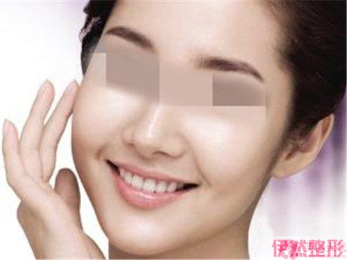 带倒钩的线实行面部埋线可维系24个月吗？