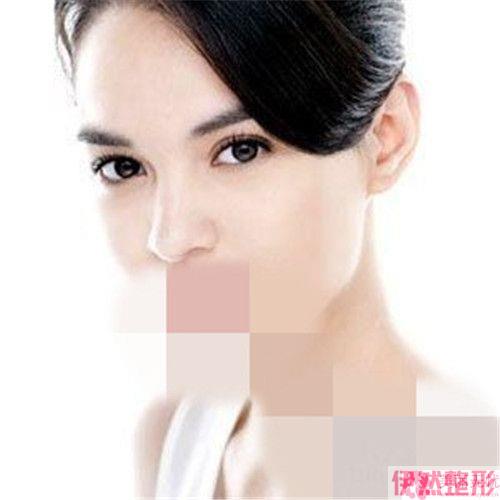 大耳缩小术前的准备和副作用是什么