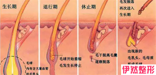 激光腿部脱毛的手术果是自然的吗