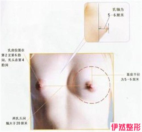 乳晕再造手术适合哪些女性朋友
