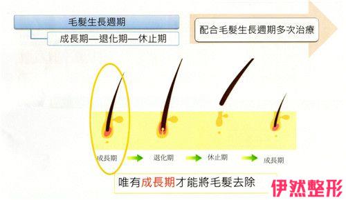 做激光脱毛6855元钱够了吗