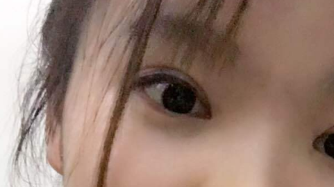 全切双眼皮几天可以碰水?全切双眼皮多久可以接眼睫毛?