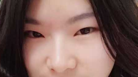 全切双眼皮可能出现的问题有哪些?全切双眼皮有硬疙瘩是怎么回事?