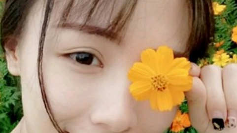 全切双眼皮需要吃消炎药吗?全切双眼皮几天可以上班?